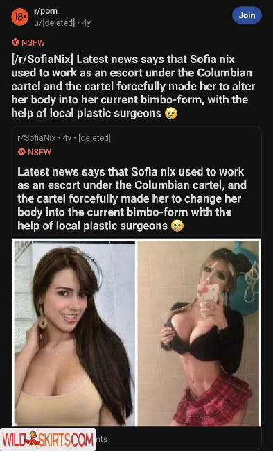 Before and After : Pornstar Boobjobs / Before and After : Pornstar Boobjobs / _celebrities_before_after_ nude OnlyFans, Instagram leaked photo #11