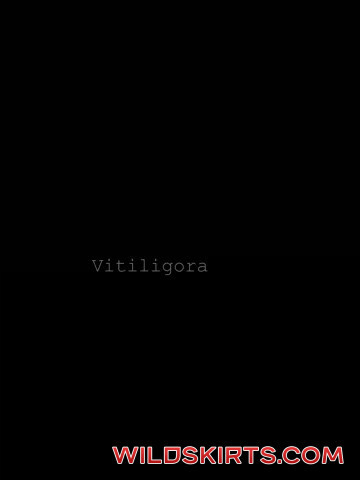 Vitiligora / vitiligora nude OnlyFans leaked video #34