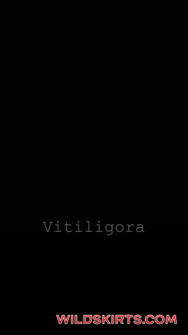 Vitiligora / vitiligora nude OnlyFans leaked video #21