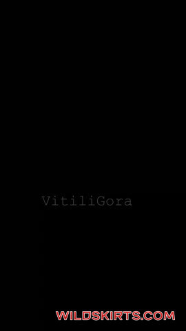 Vitiligora / vitiligora nude OnlyFans leaked video #20