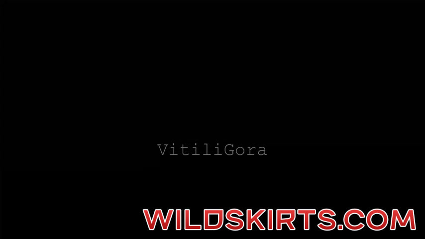 Vitiligora / vitiligora nude OnlyFans leaked video #24