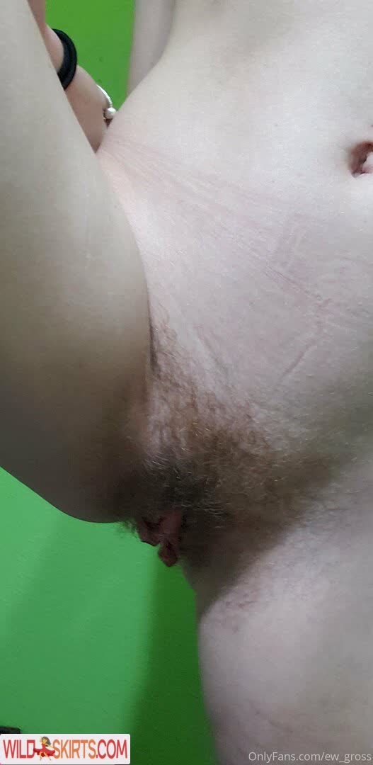 Ew_gross nude leaked photo #35